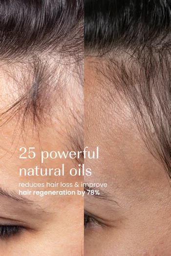 Densify Strengthening Hair Oil, 190ml