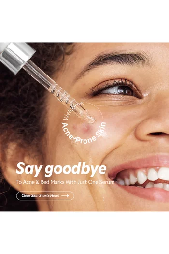 سيروم حمض الأزيليك 12‏‏‏%، 30 ملل